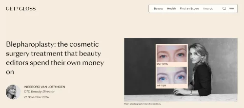 Blepharoplasty: the cosmetic surgery treatment that beauty editors spend their own money on