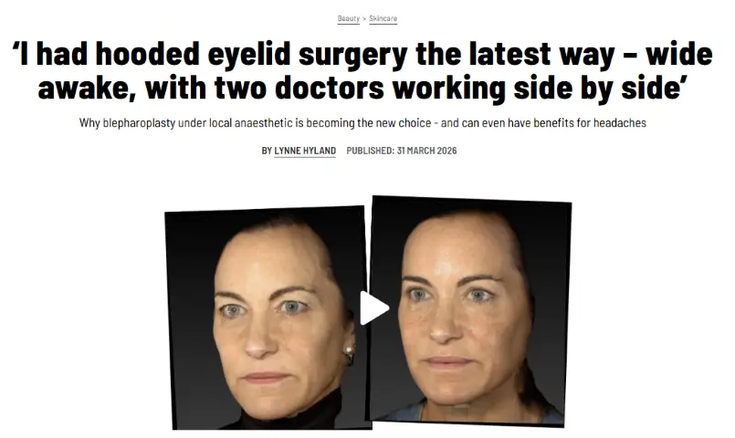 ‘I had hooded eyelid surgery the latest way – wide awake, with two doctors working side by side’