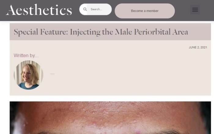 Injecting the Male Periorbital Area