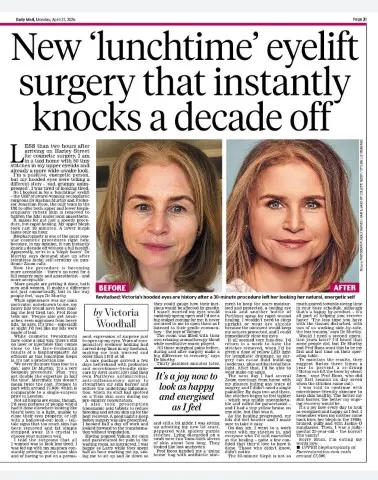 New ‘lunchtime’ eyelift surgery that instantly knocks a decade off