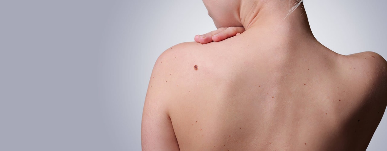 Minor surgical procedures for skin lesions and cysts