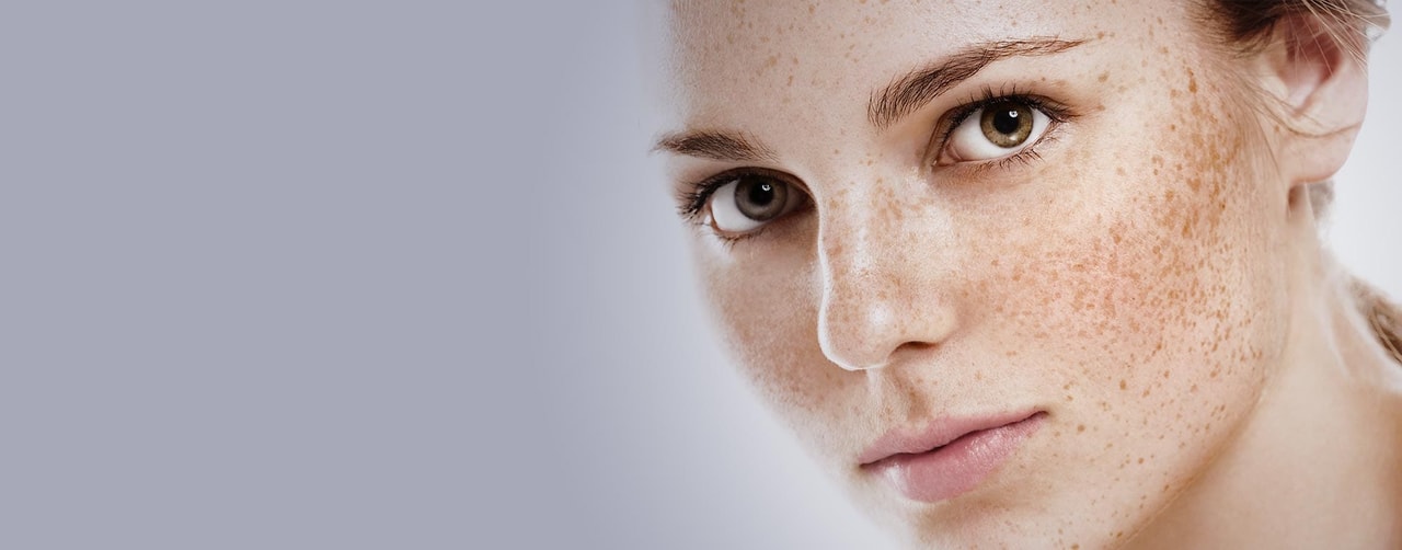 Fraxel Skin Resurfacing
