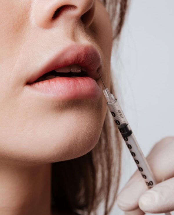 Hyalase, dermal filler reversal
