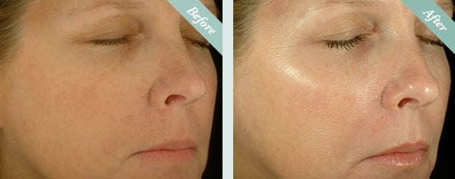 Obagi medical-grade skincare consultation