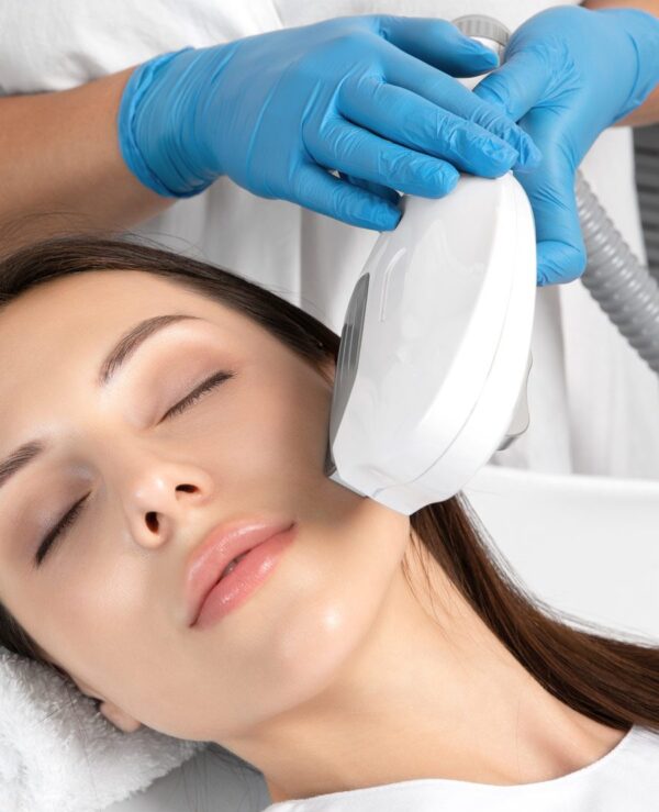 Optilight IPL treatment